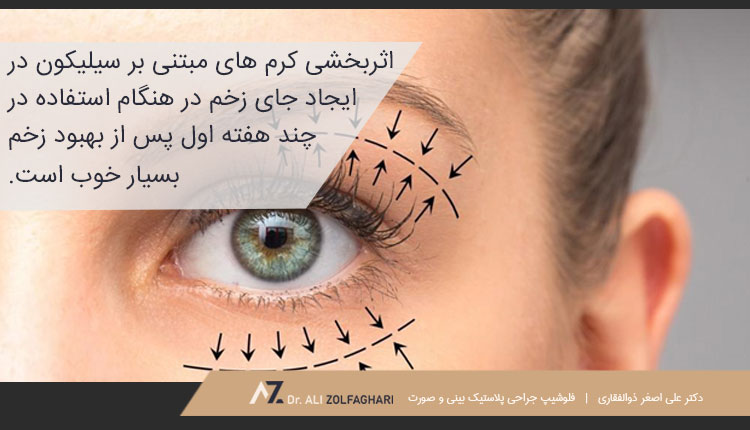 استفاده از کرم یا پماد در از بین بردن جای بخیه عمل پلک