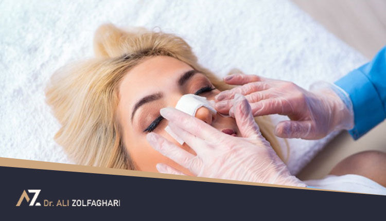 اسپلینت بینی | روند قرار گرفتن اسپلینت خارجی و داخلی بینی