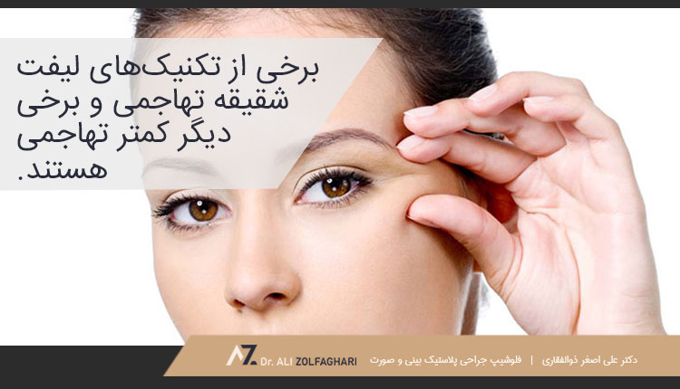 انواع لیفت شقیقه