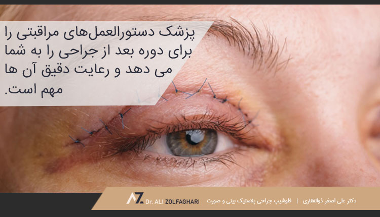 بعد از جراحی مراقب خود و پلک های خود باشید