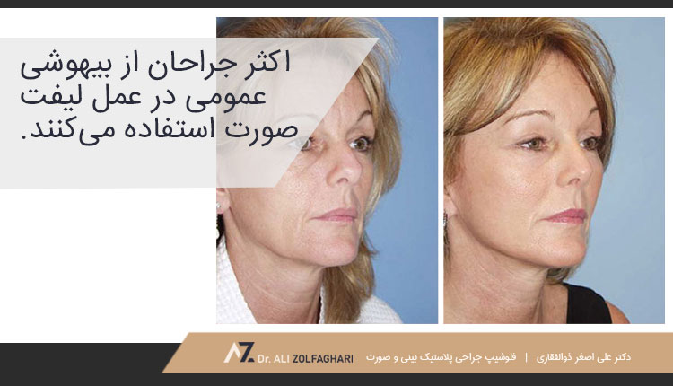 اندوسکوپی سنتی