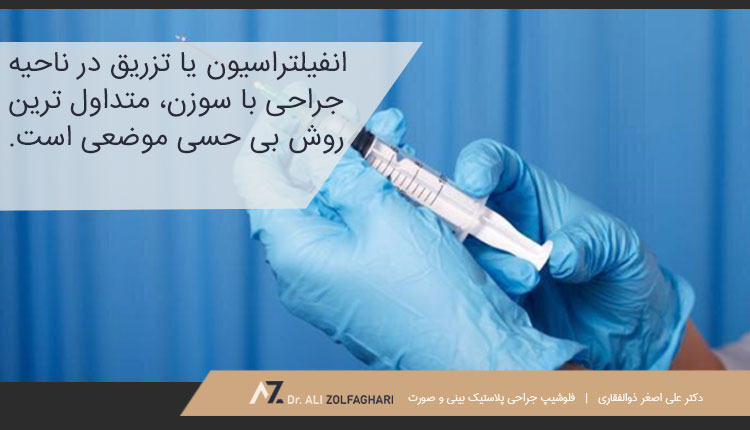 تزریق بی حسی موضعی