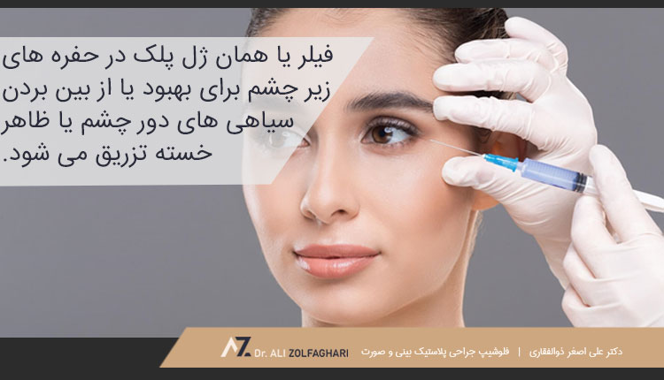 تزریق ژل به پلک، راهی برای جوانسازی چشم