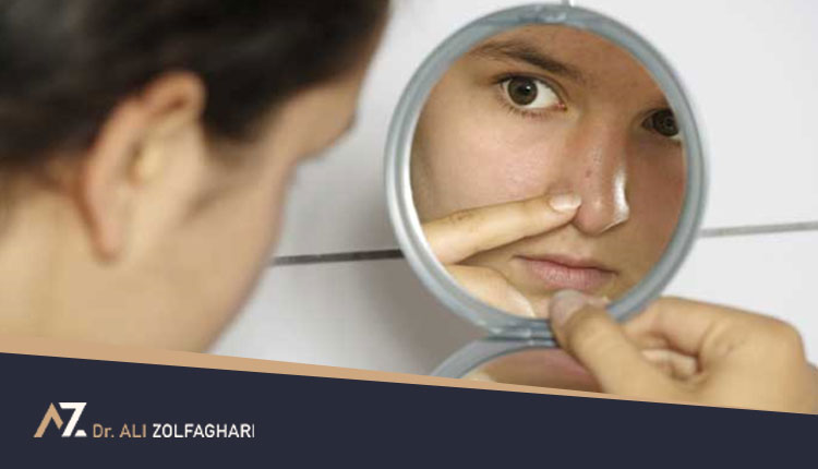 دلایل جوش زدن بعد از عمل بینی