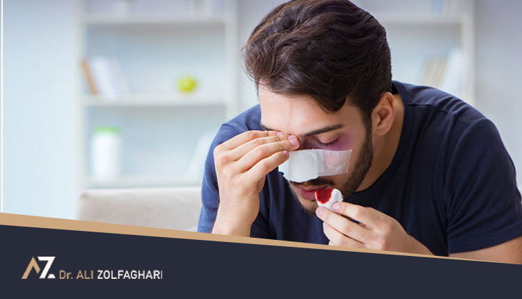 روش های پیشگیری و درمان خونریزی بعد از عمل بینی