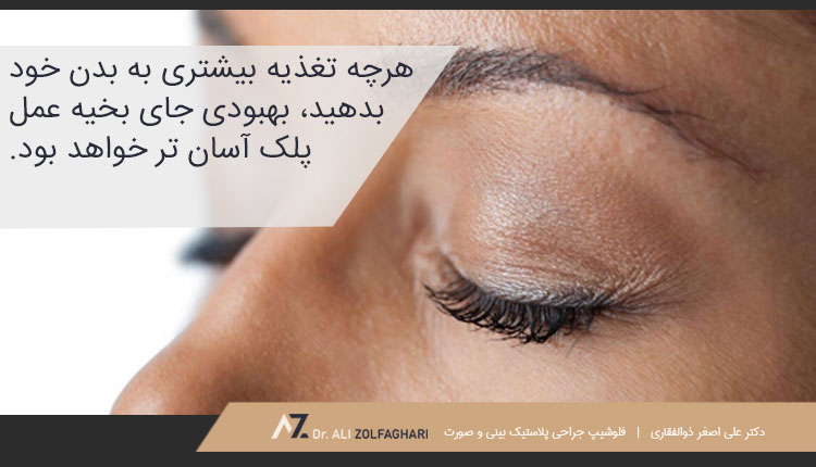 سبک زندگی سالم را حفظ کنید برای از بین بردن جای بخیه عمل پلک