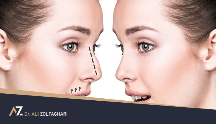 عمل همزمان انحراف بینی و زیبایی | هزینه جراحی انحراف بینی