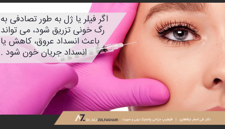 عوارض جانبی تزریق ژل