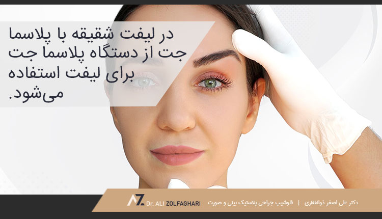 لیفت شقیقه با پلاسما جت