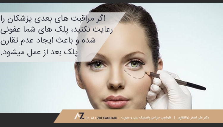 دلایل عدم تقارن پلک بعد از عمل بلفاروپلاستی