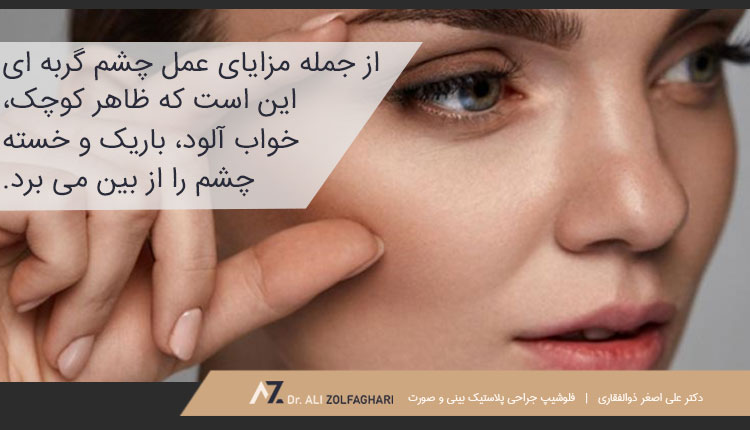 مزایای عمل چشم گربه ای