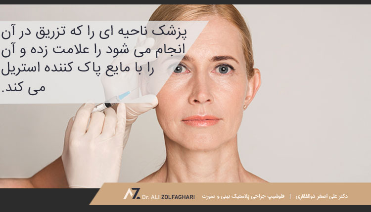 نحوه انجام و مراحل