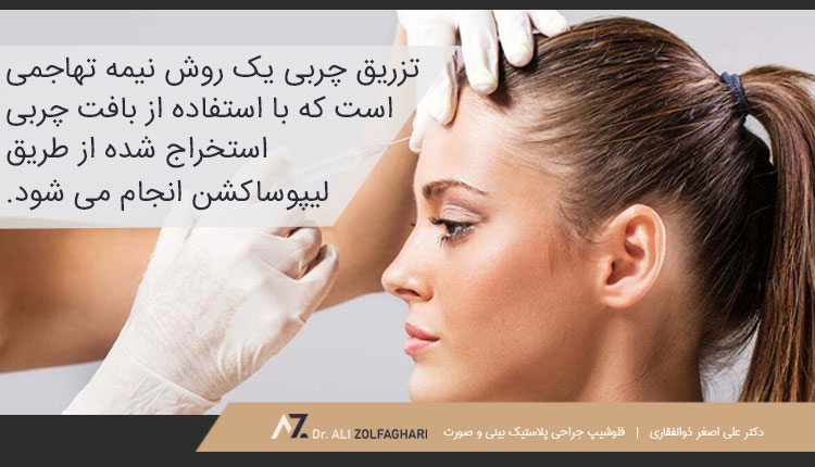 تزریق چربی روشی نیمه تهاجمی برای صورت
