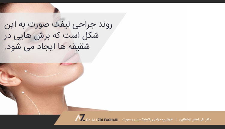 جراحی لیفت صورت و جای زخم ناشی از آن