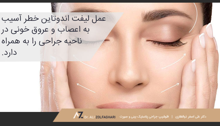 خطرات و عوارض جراحی لیفت صورت با اندوتاین
