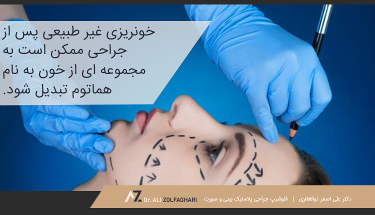 عوارض جراحی لیفت صورت