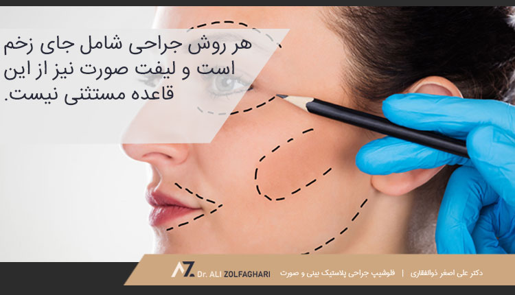 عوارض جراحی لیفت صورت