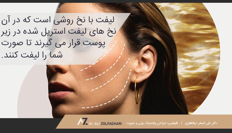 لیفت با نخ چیست؟