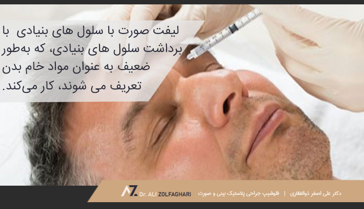 لیفت صورت با سلول های بنیادی