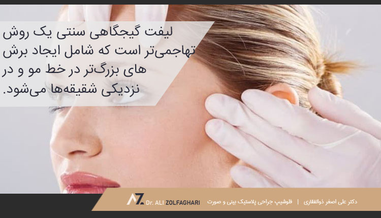 لیفت گیجگاهی سنتی