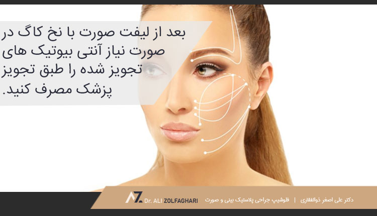 مراقبت های بعد از لیفت صورت با نخ کاگ