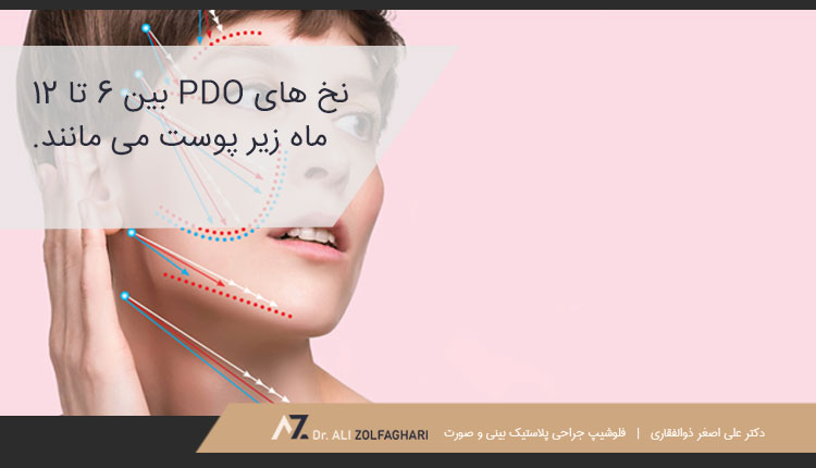 میزان ماندگاری لیفت صورت با نخ