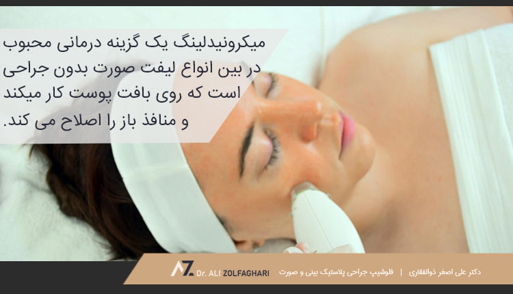 میکرونیدلینگ از دیگر روش های لیفت صورت بدون جراحی