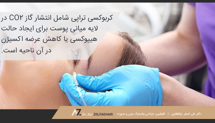 کربوکسی تراپی و انتشار گاز co2 در لایه میانی پوست