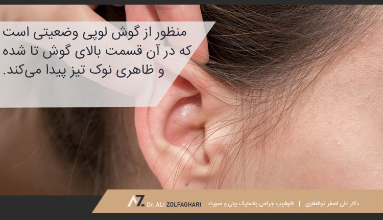 اتوپلاستی گوش لوپی