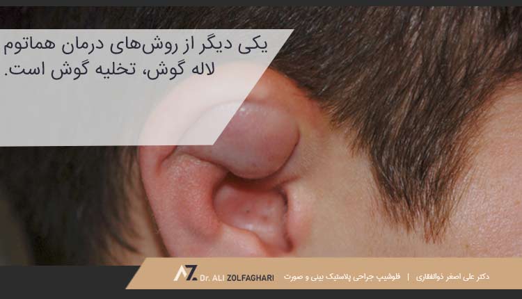 روش های درمان هماتوم لاله گوش