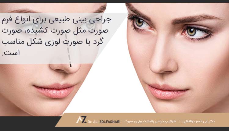 جراحی بینی طبیعی برای انواع فرم صورت |مدل جراحی بینی متناسب با چهره