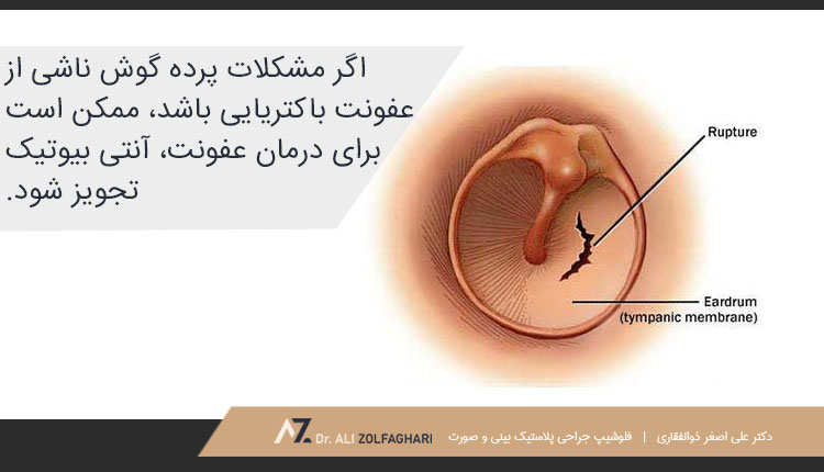 روش‌های درمان پرده گوش آسیب دیده یا پاره شده