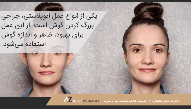 عمل جراحی بزرگ کردن گوش