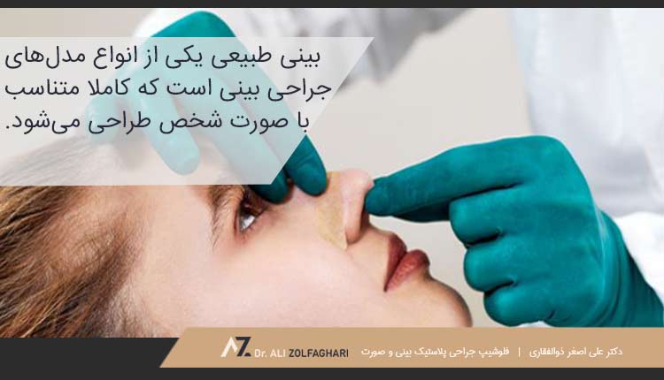 مدل بینی طبیعی
