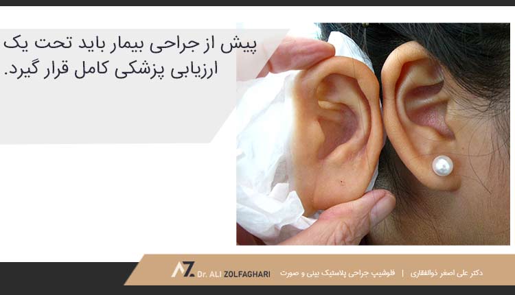 مراحل انجام عمل پروتز گوش
