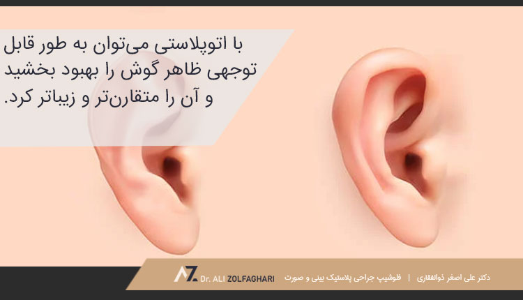 مزایای عمل اتوپلاستی