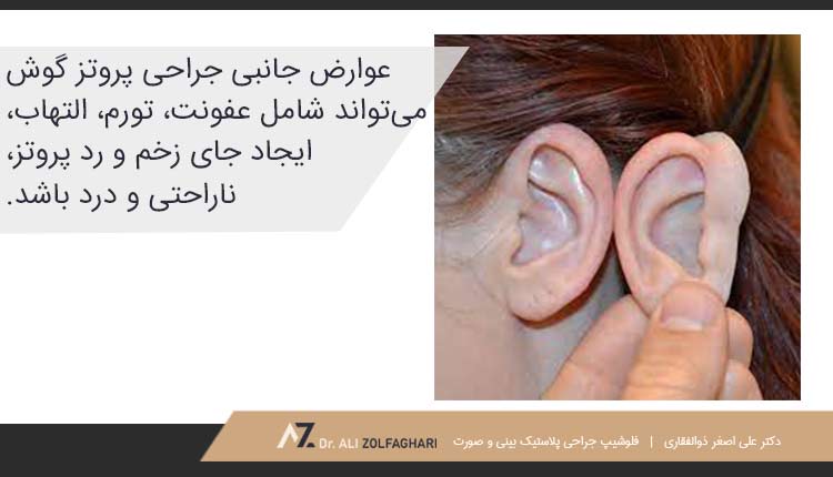 معایب عمل پروتز گوش مصنوعی