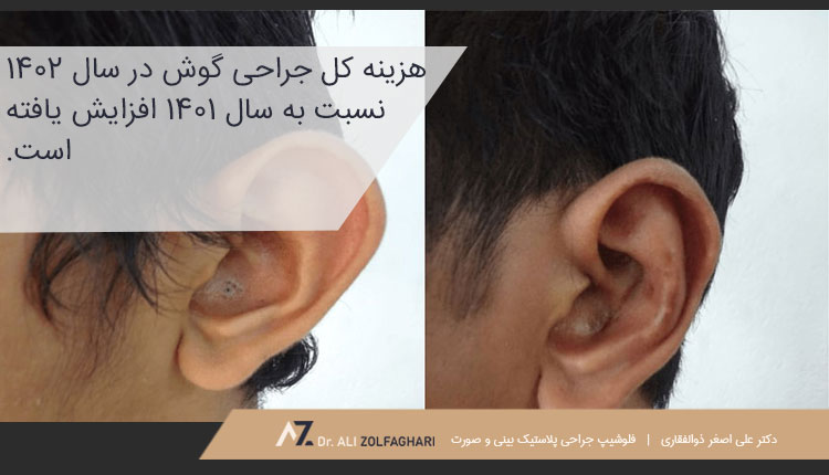 هزینه جراحی گوش در سال ۱۴۰۱ و ۱۴۰۲