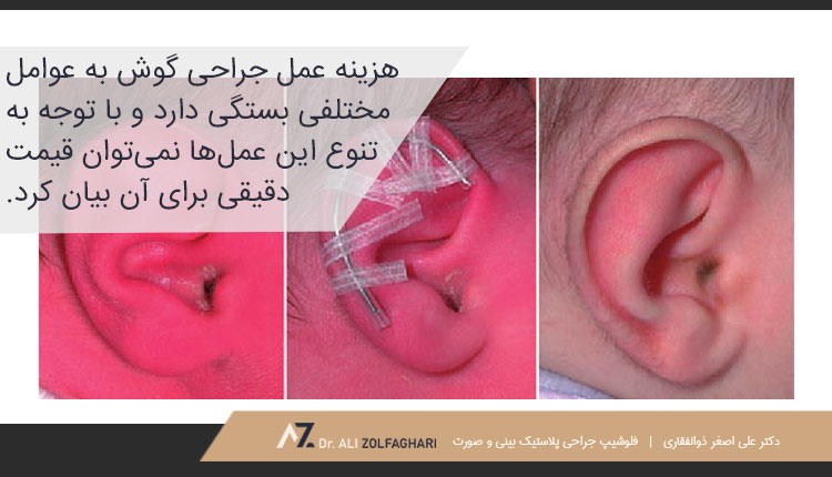 هزینه عمل جراحی گوش چقدر است؟
