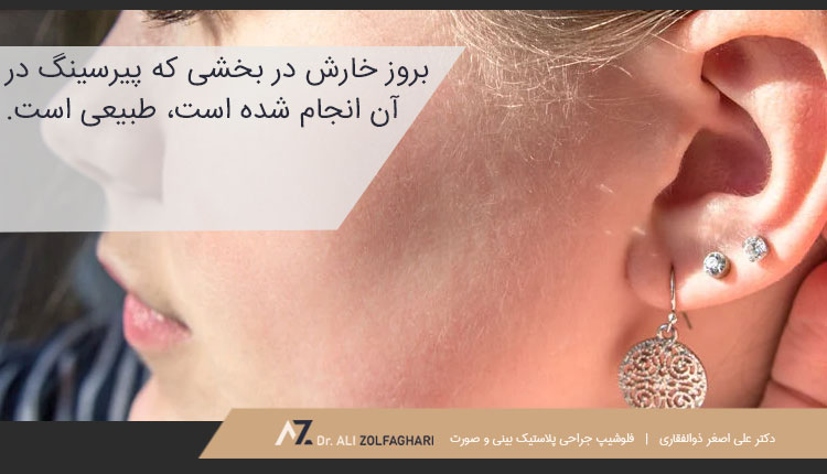 پیرسینگ گوش یکی از عوامل خارش گوش