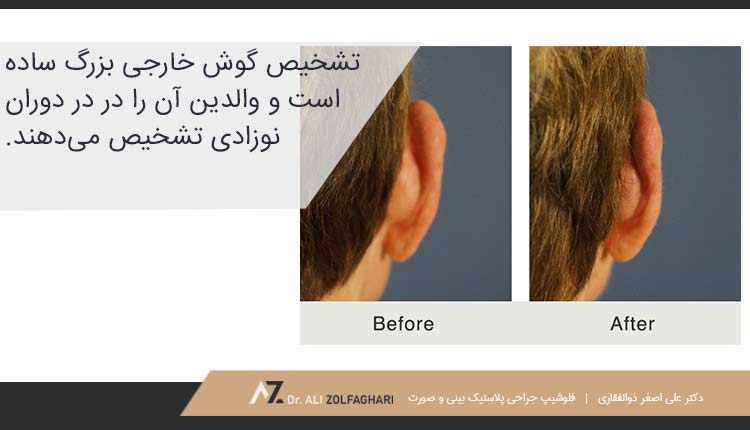 گوش خارجی بزرگ چیست؟
