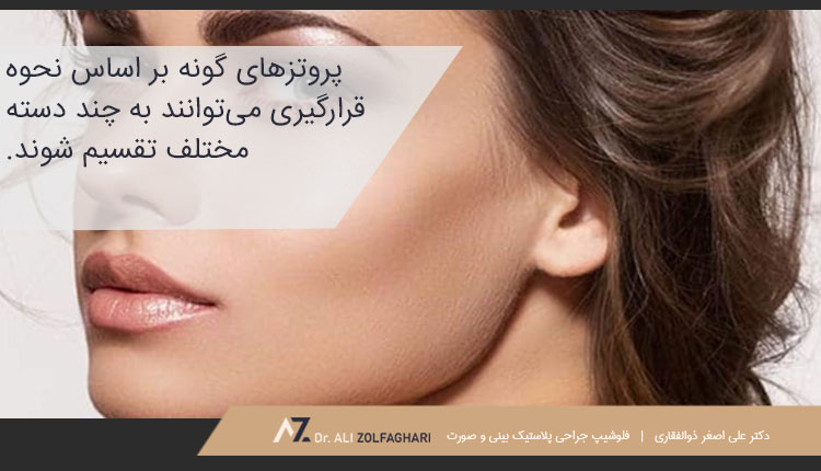 انواع پروتز گونه