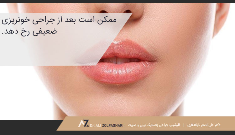 آیا کاشت پروتز گونه عوارض دارد؟