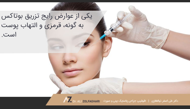 عوارض تزریق بوتاکس به گونه