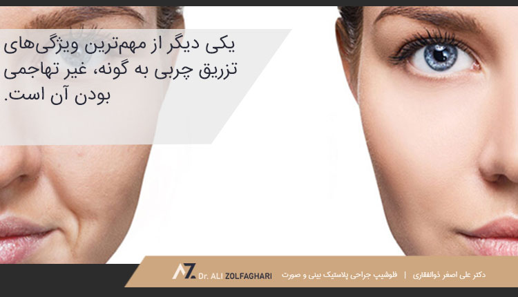تزریق چربی به گونه غیر تهاجمی