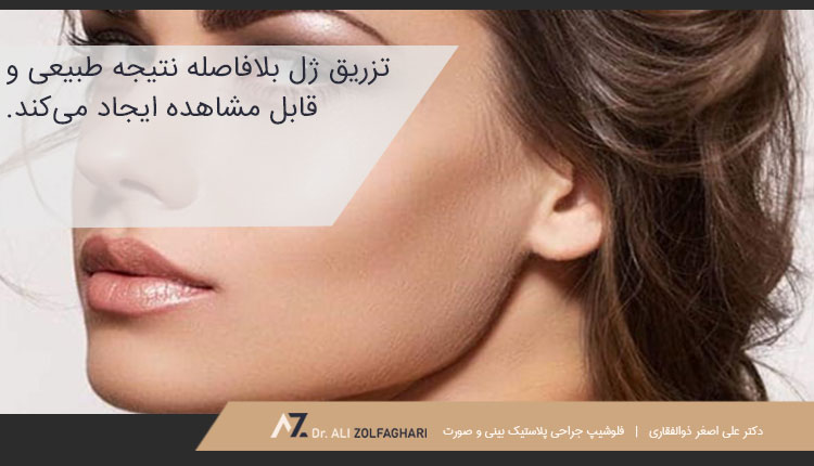 نتایج تزریق ژل به گونه