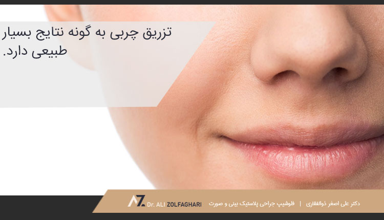 نتایج طبیعی از تزریق چربی به گونه