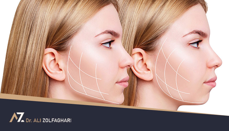 تزریق ژل به چانه | مضرات تزریق ژل به چانه