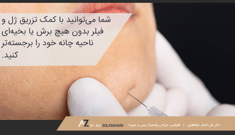 منظور از تزریق ژل به چانه چیست؟