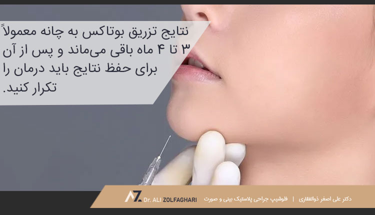 میزان ماندگاری تزریق بوتاکس به چانه چقدر است؟